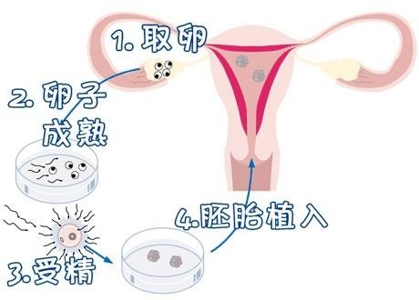 冷冻